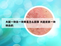 大腿一块白一块黄是怎么回事 大腿皮肤一块块白的