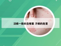 汉癣一般长在哪里 汗癣的危害