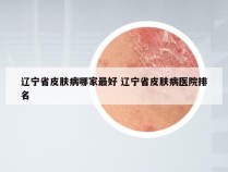 辽宁省皮肤病哪家最好 辽宁省皮肤病医院排名