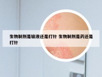 生物制剂是输液还是打针 生物制剂是药还是打针