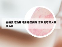 百癣夏塔热片可用哪些病症 百癣夏塔热片有什么用