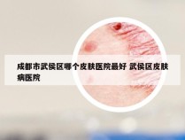 成都市武侯区哪个皮肤医院最好 武侯区皮肤病医院