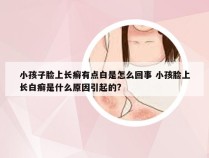 小孩子脸上长癣有点白是怎么回事 小孩脸上长白癣是什么原因引起的?