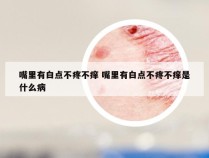 嘴里有白点不疼不痒 嘴里有白点不疼不痒是什么病