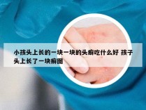 小孩头上长的一块一块的头癣吃什么好 孩子头上长了一块癣图