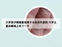 六岁孩子眼睛里有两个小白点不底劲 六岁儿童白眼珠上长了一个