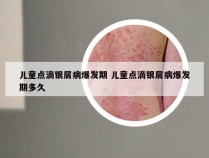 儿童点滴银屑病爆发期 儿童点滴银屑病爆发期多久