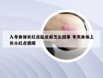 入冬身体长红点起皮癣怎么回事 冬天身体上长小红点很痒