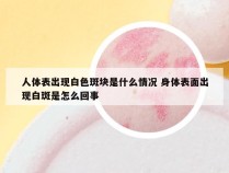 人体表出现白色斑块是什么情况 身体表面出现白斑是怎么回事