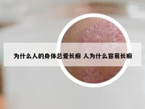 为什么人的身体总爱长癣 人为什么容易长癣