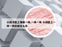 小孩子脸上像癣一样,一块一块 小孩脸上一块一块的癣怎么办