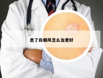 患了白癜风怎么治更好