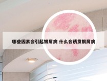 哪些因素会引起银屑病 什么会诱发银屑病