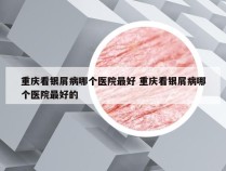 重庆看银屑病哪个医院最好 重庆看银屑病哪个医院最好的