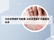 小红点然后扩大起癣 小红点然后扩大起癣怎么办