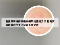 他克莫司涂抹手指白癜风的正确方法 他克莫司软膏治疗手上白斑多久见效