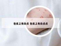 包皮上有白点 包皮上有白点点