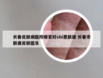 长春皮肤病医院哪家好shi惠肤康 长春市肤康皮肤医生