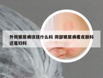 外阴银屑病该挂什么科 阴部银屑病看皮肤科还是妇科