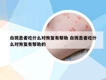 白斑患者吃什么对恢复有帮助 白斑患者吃什么对恢复有帮助的