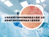 小孩皮肤病打哪种生物制剂能进入医保 小孩皮肤病打哪种生物制剂能进入医保报销