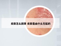 皮藓怎么回事 皮藓是由什么引起的