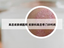 吴忠皮肤病医院 皮肤科吴忠孝门诊时间