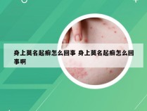 身上莫名起癣怎么回事 身上莫名起癣怎么回事啊