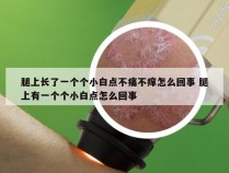 腿上长了一个个小白点不痛不痒怎么回事 腿上有一个个小白点怎么回事