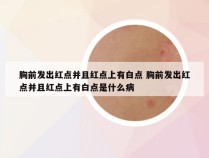 胸前发出红点并且红点上有白点 胸前发出红点并且红点上有白点是什么病