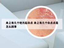 身上有几个地方起白点 身上有几个白点点是怎么回事