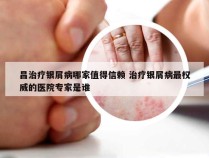 昌治疗银屑病哪家值得信赖 治疗银屑病最权威的医院专家是谁