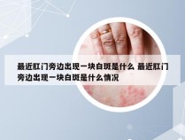 最近肛门旁边出现一块白斑是什么 最近肛门旁边出现一块白斑是什么情况