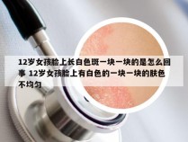 12岁女孩脸上长白色斑一块一块的是怎么回事 12岁女孩脸上有白色的一块一块的肤色不均匀