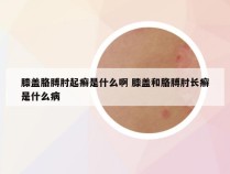 膝盖胳膊肘起癣是什么啊 膝盖和胳膊肘长癣是什么病