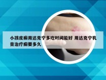 小孩皮癣用达克宁多吃时间能好 用达克宁乳膏治疗癣要多久