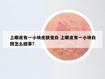 上眼皮有一小块皮肤变白 上眼皮有一小块白斑怎么回事?