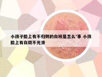 小孩子脸上有不归则的白班是怎么'事 小孩脸上有白斑不光滑