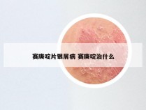 赛庚啶片银屑病 赛庚啶治什么