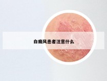 白癜风患者注意什么