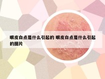 眼皮白点是什么引起的 眼皮白点是什么引起的图片