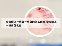 宝宝脸上一块白一块白的怎么回事 宝宝脸上一块白怎么办