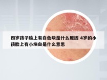 四岁孩子脸上有白色块是什么原因 4岁的小孩脸上有小块白是什么意思