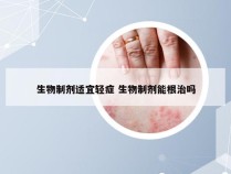 生物制剂适宜轻症 生物制剂能根治吗