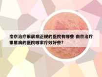 南京治疗银屑病正规的医院有哪些 南京治疗银屑病的医院哪家疗效好些?