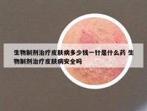 生物制剂治疗皮肤病多少钱一针是什么药 生物制剂治疗皮肤病安全吗