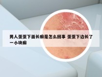 男人蛋蛋下面长癣是怎么回事 蛋蛋下边长了一小块癣