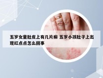 五岁女童肚皮上有几片癣 五岁小孩肚子上出现红点点怎么回事