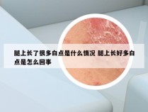 腿上长了很多白点是什么情况 腿上长好多白点是怎么回事