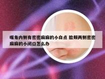 嘴角内侧有密密麻麻的小白点 脸颊两侧密密麻麻的小闭口怎么办